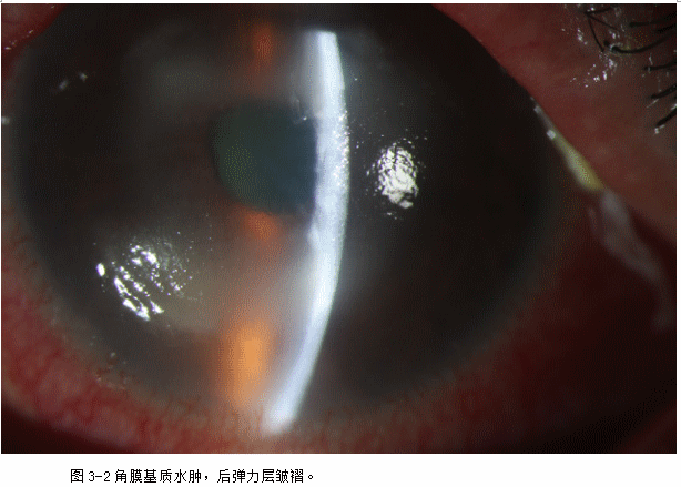 ZY016_11_3.gif